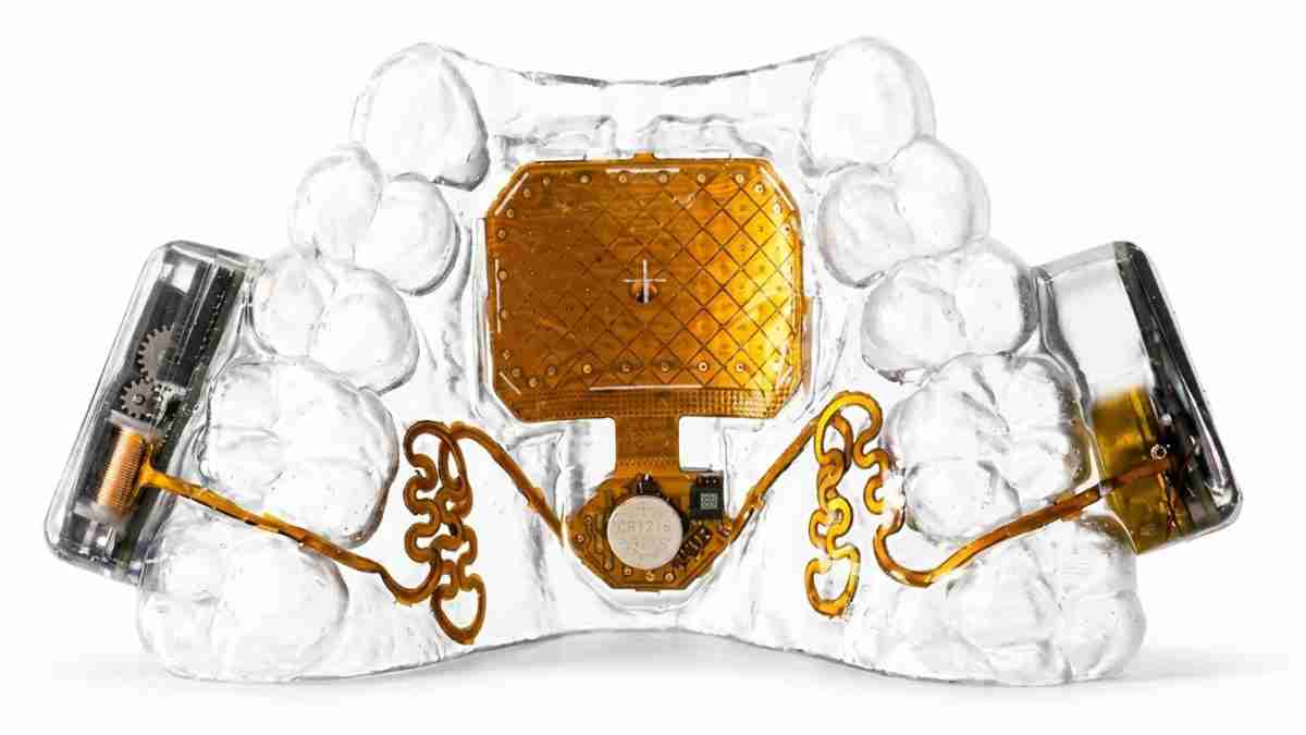 Cross-section model of an implantable medical device with an orange circuit board embedded in a clear dental arch model. The central orange module has a cross pattern and is connected to gold-tone circuitry along the sides.
